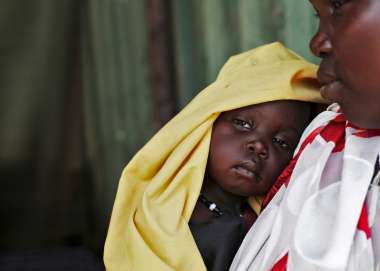 Nyamuot Joak and her 12 month old daughter Nyayiena Gatkuoth who has just been diagnosed with Severe Acute Malnutrition